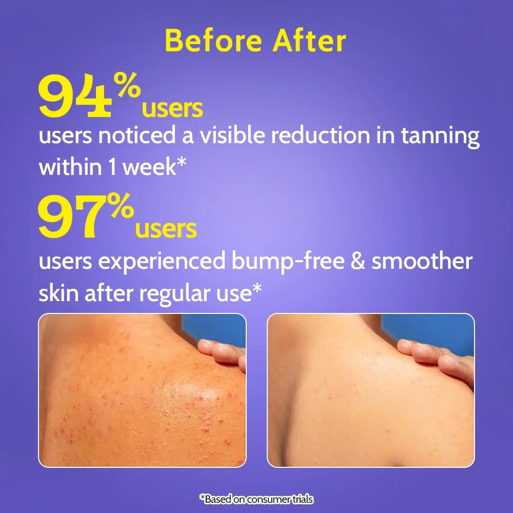 Chemist at Play Exfoliating Body Wash 4% Lactic acid + Salicylic Acid + Vitamin E (236mL)