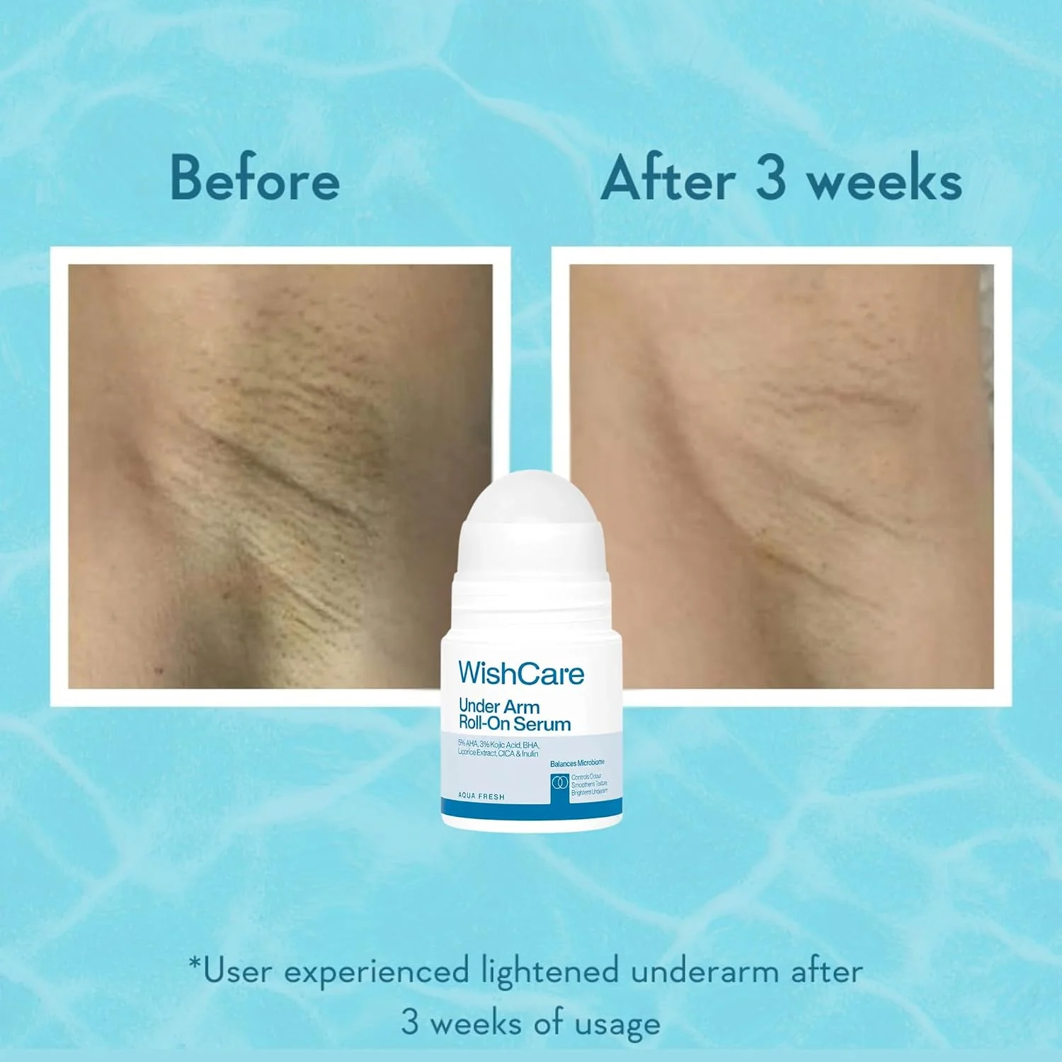 WishCare Under Arm Roll On Serum (50mL)