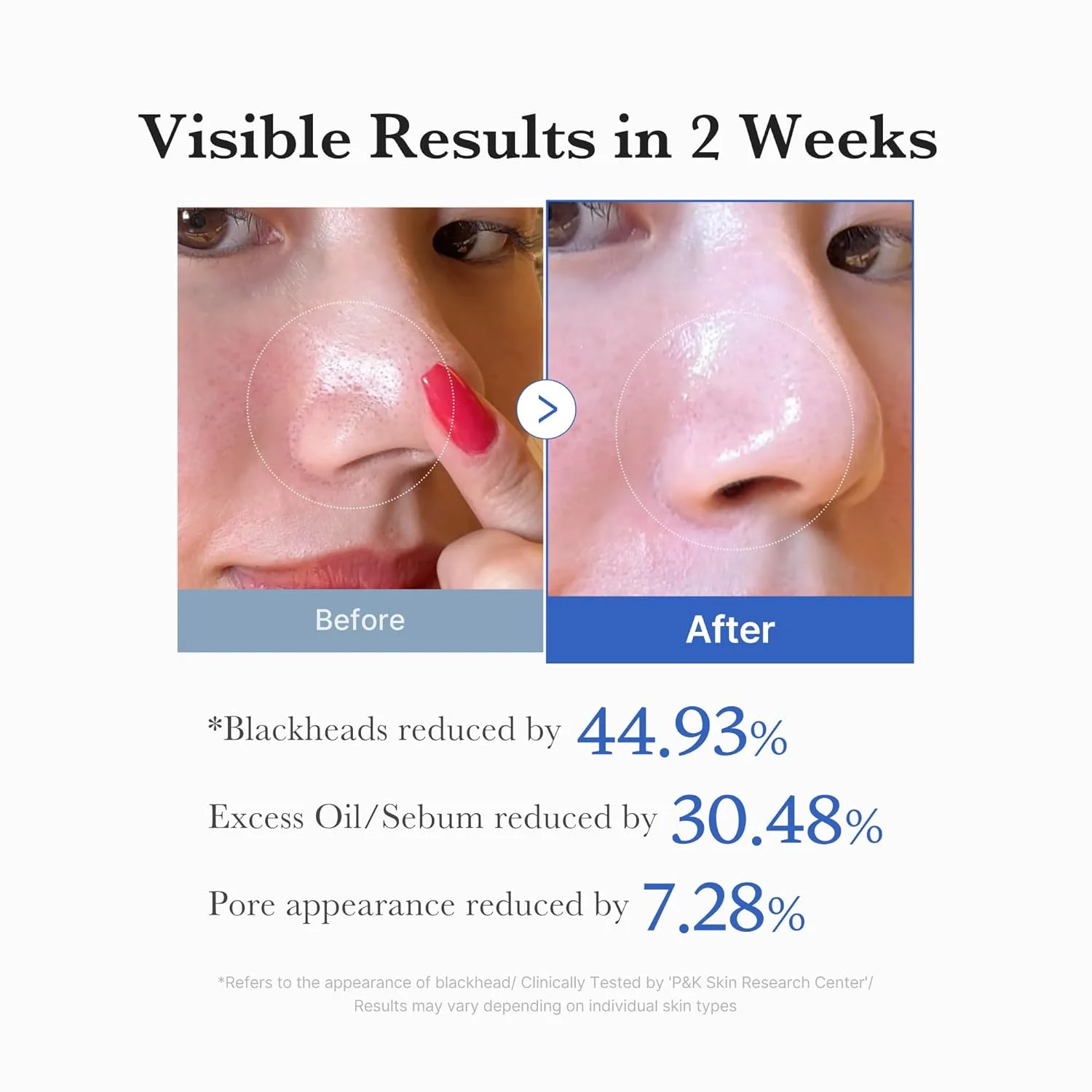 medicube Zero Pore Pad 2.0 (70 Pads)