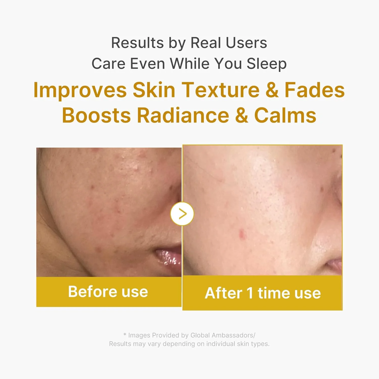 medicube Kojic Acid Turmeric Night Wrapping Mask (75mL)