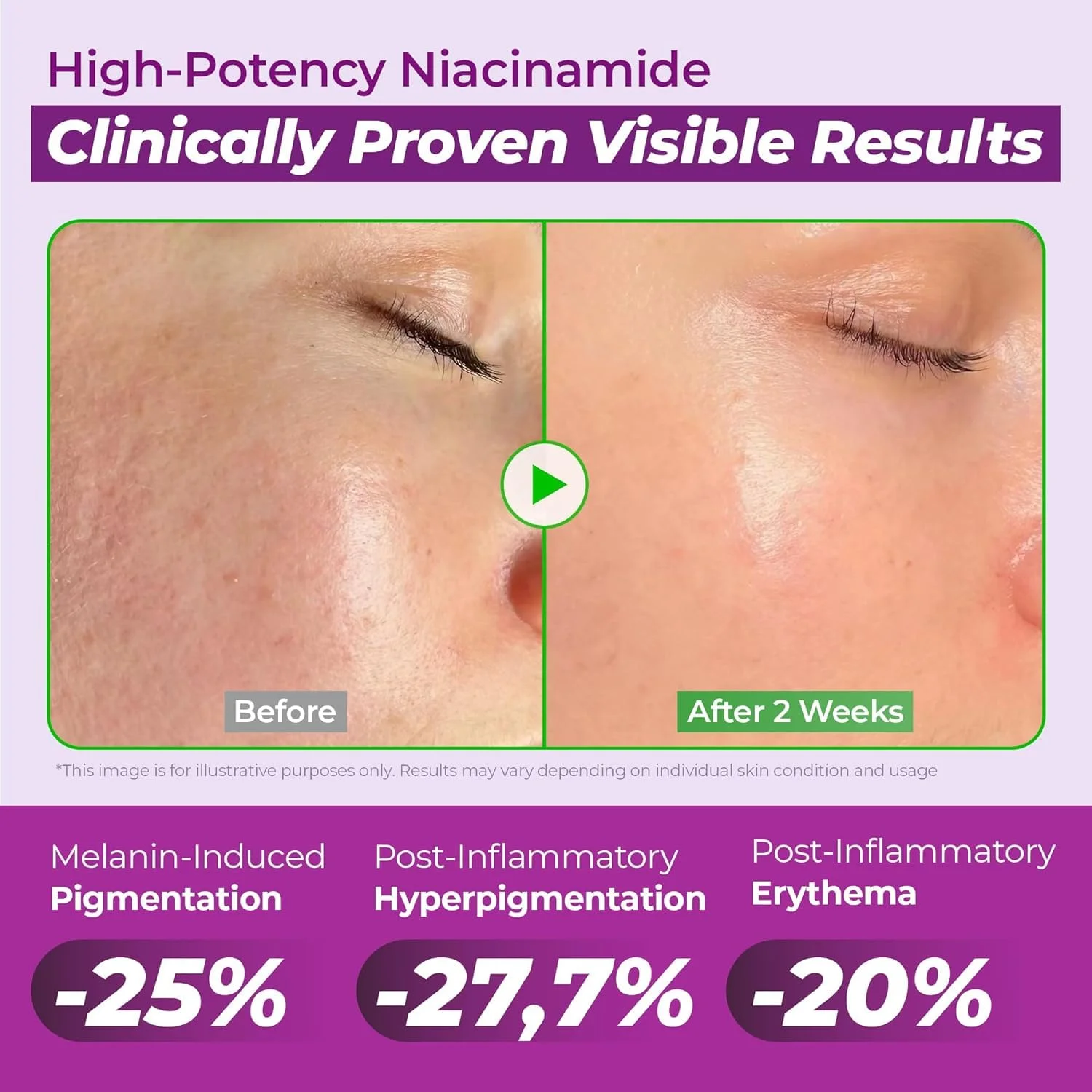 JUMISO Niacinamide 20 Serum (40mL)