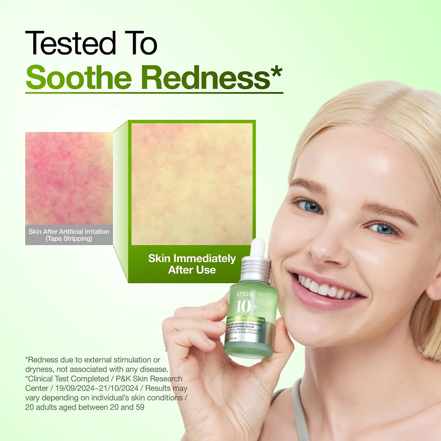 Anua Azelaic Acid 10 Hyaluron Redness Soothing Serum (30mL)