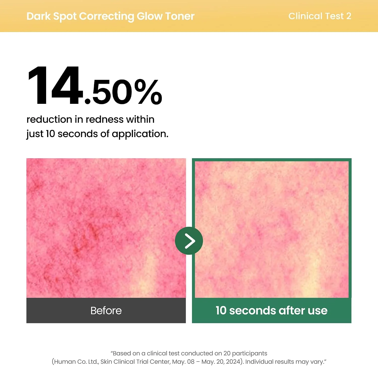 AXIS-Y Dark Spot Correcting Glow Toner (125mL)