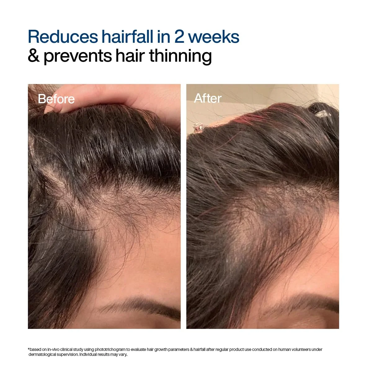 WishCare Hair Growth Serum Concentrate (30mL)