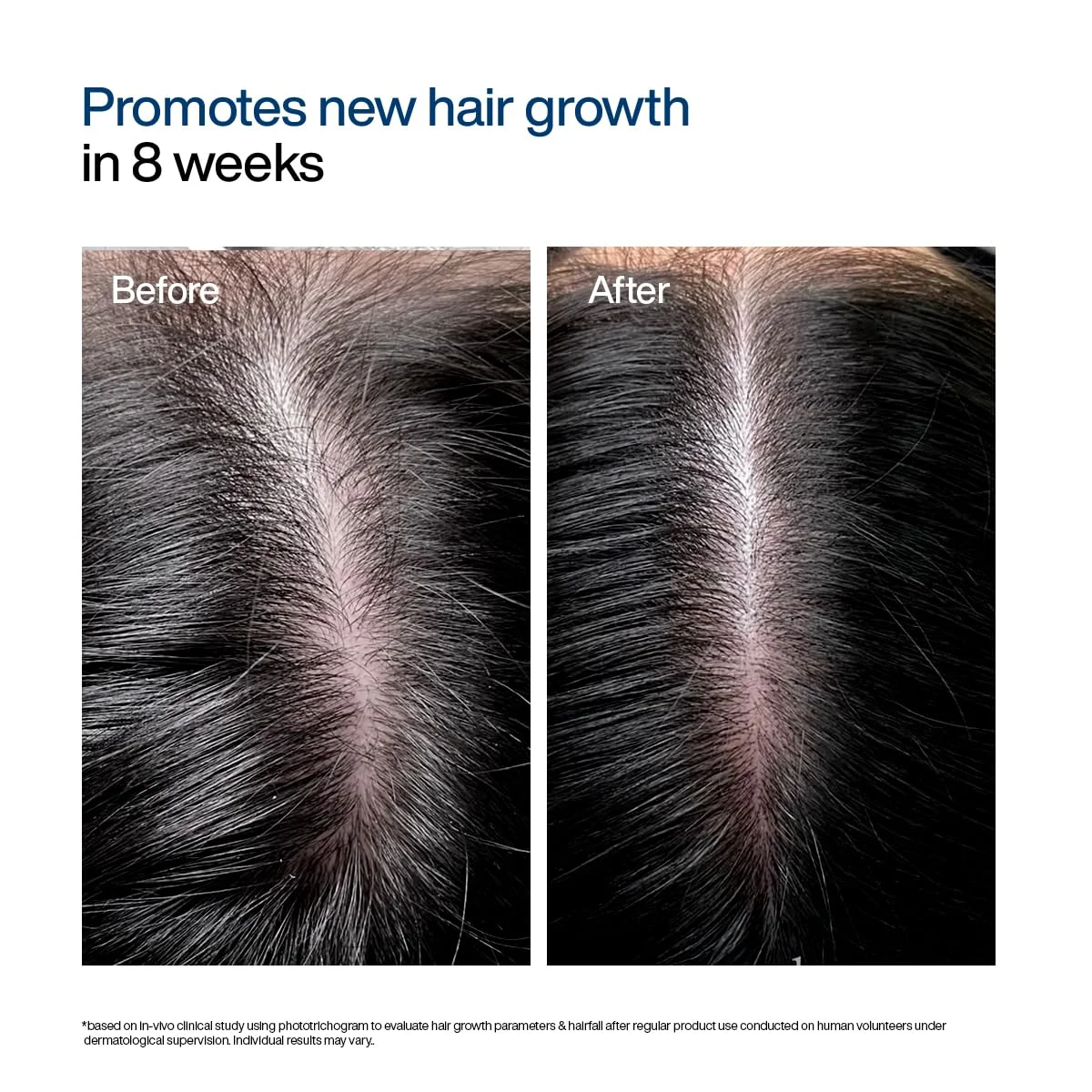 WishCare Hair Growth Serum Concentrate (30mL)