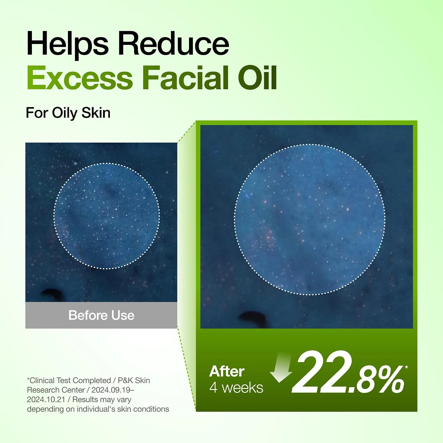 Anua Azelaic Acid 10 Hyaluron Redness Soothing Serum (30mL)