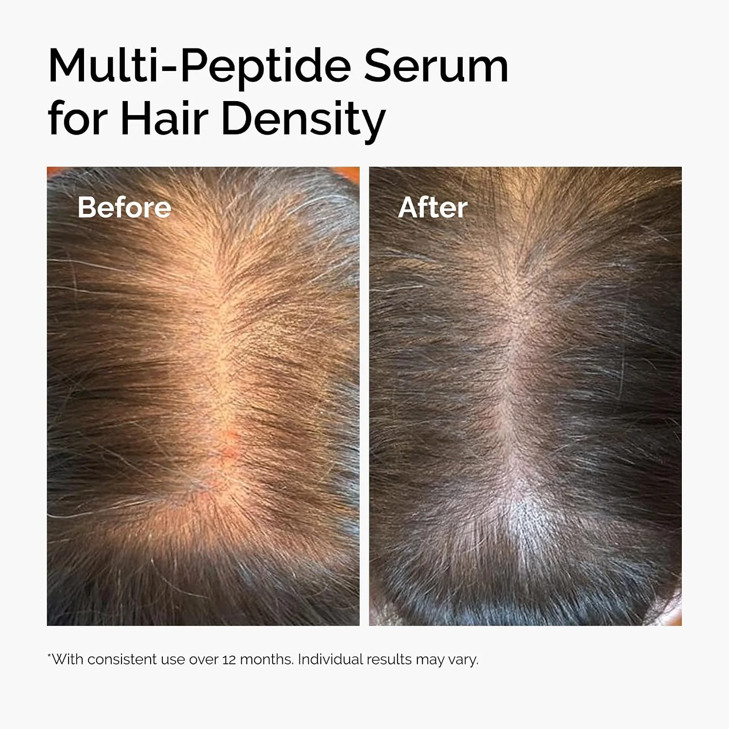 The Ordinary Multi-Peptide Serum for Hair Density Travel Size (30mL)